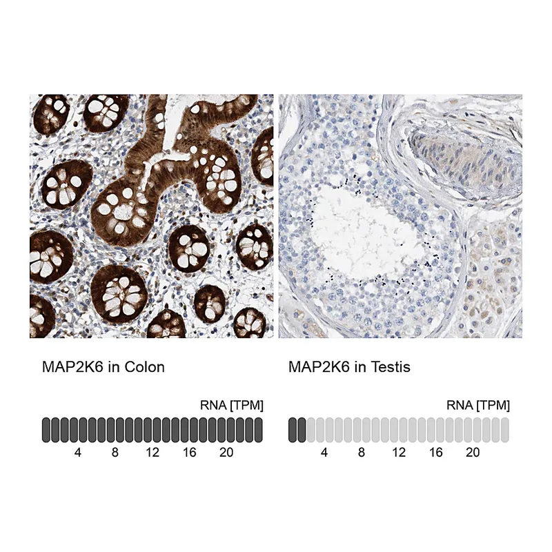 Atlas Antibodies Anti-MAP2K6 Antibody