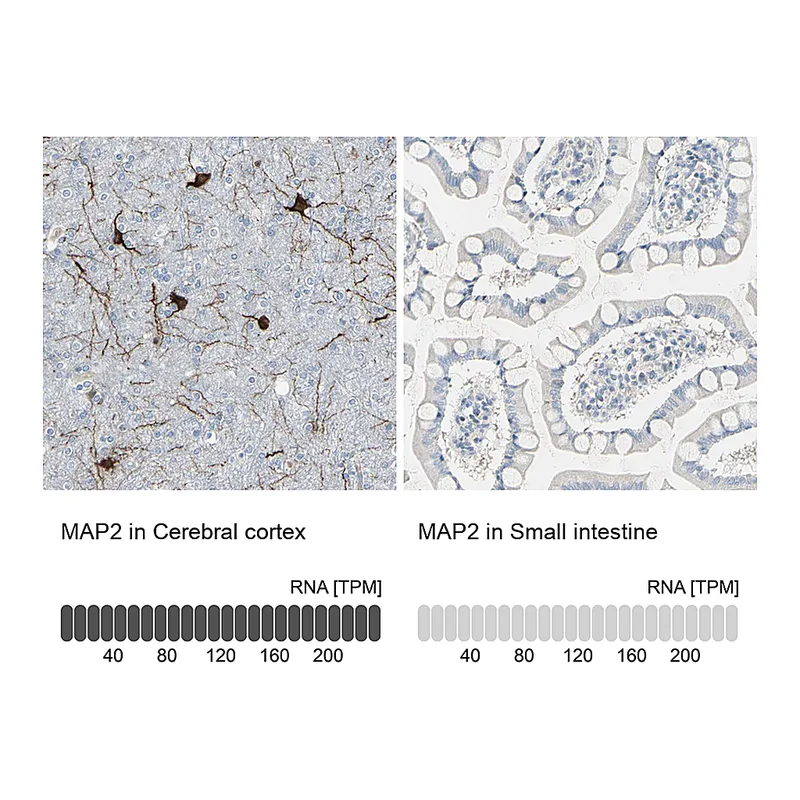 Atlas Antibodies Anti-MAP2 Antibody