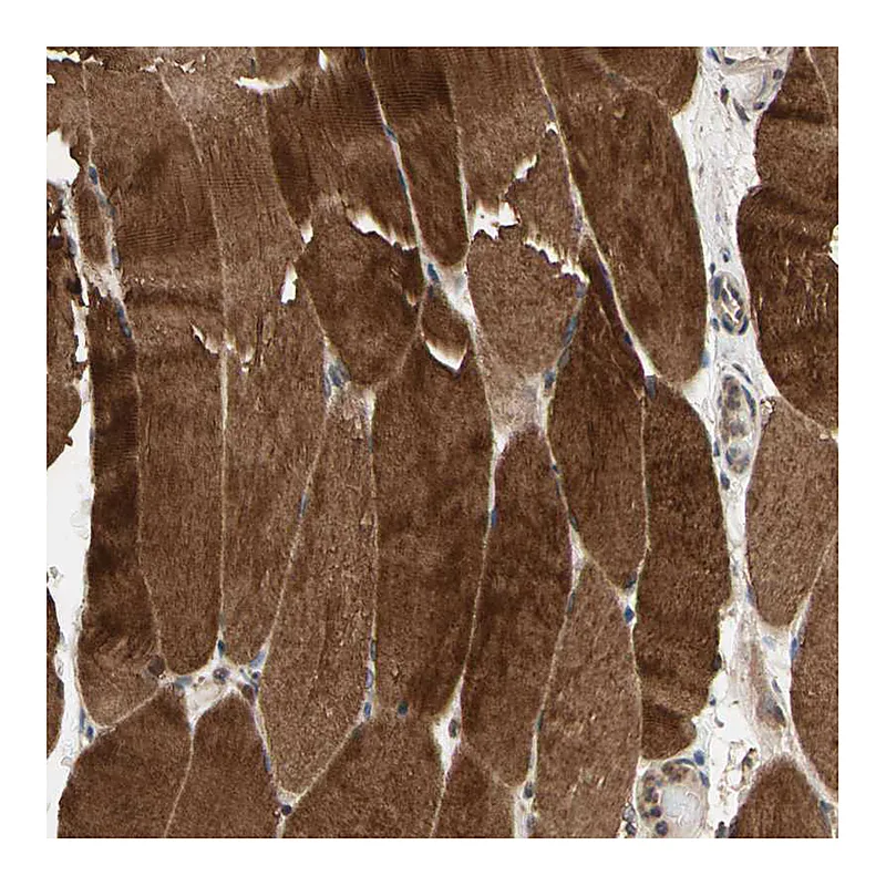 Atlas Antibodies Anti-MAP3K10 Antibody