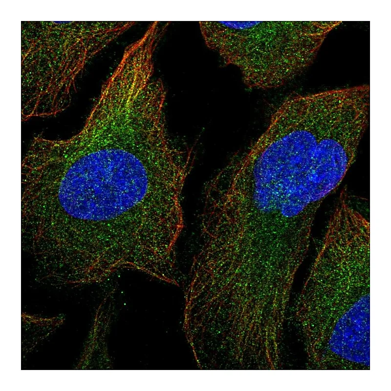 Atlas Antibodies Anti-MAP3K1 Antibody