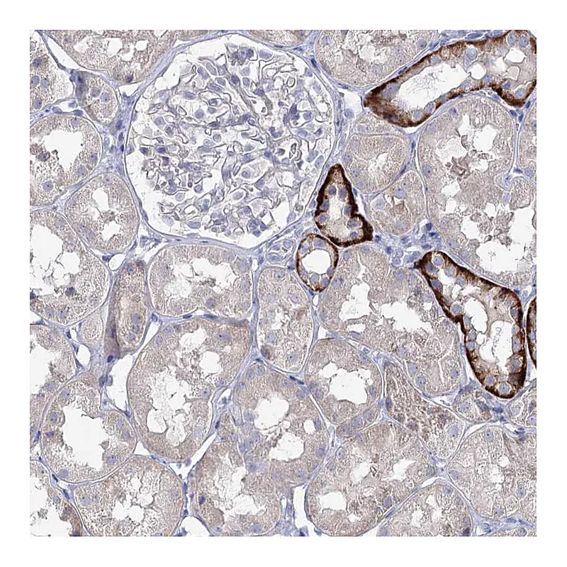 Atlas Antibodies Anti-MAP3K13 Antibody