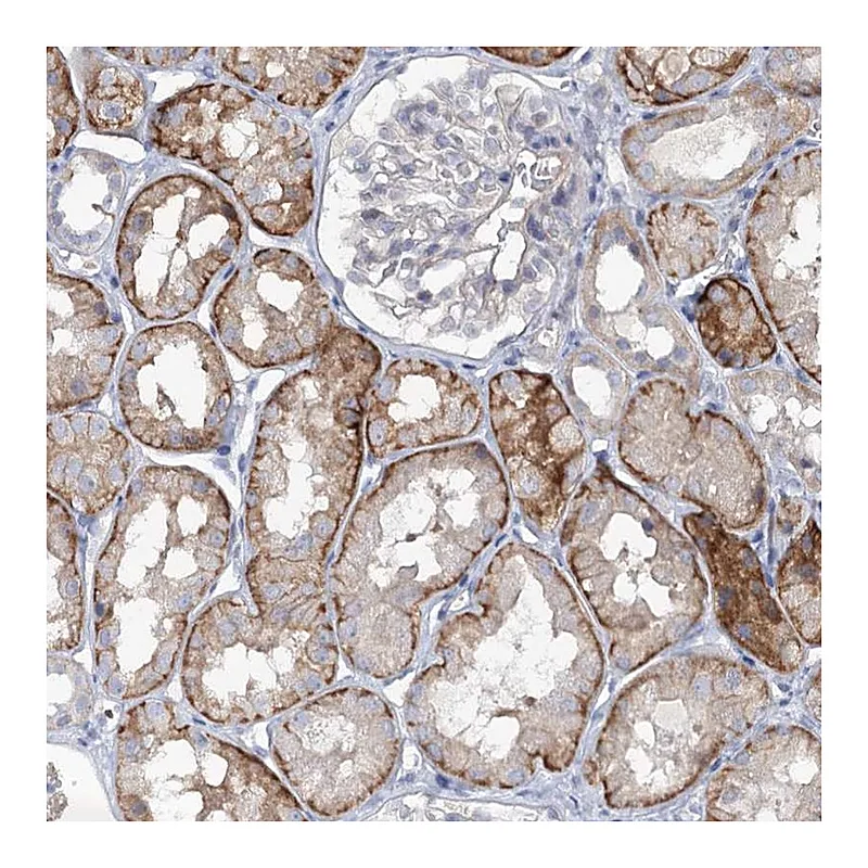 Atlas Antibodies Anti-MAP3K13 Antibody