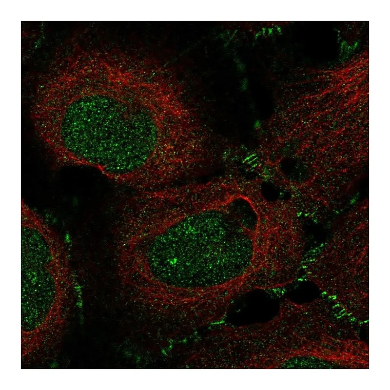 Atlas Antibodies Anti-MAP3K12 Antibody