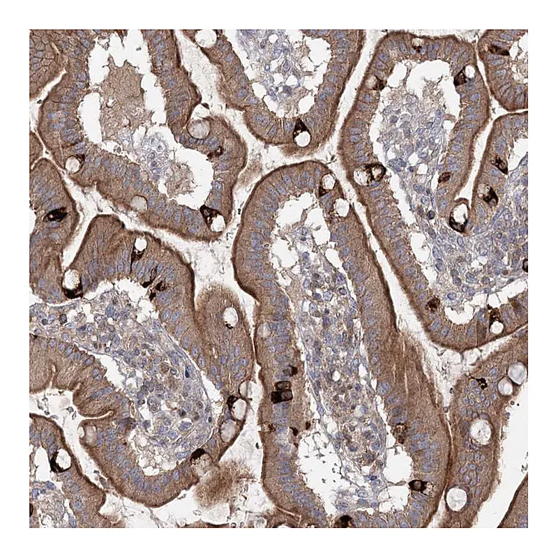 Atlas Antibodies Anti-MAP3K13 Antibody