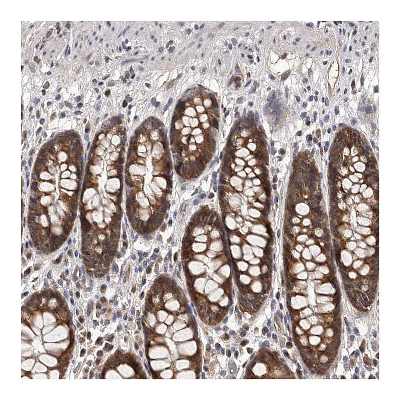 Atlas Antibodies Anti-MAP3K14 Antibody