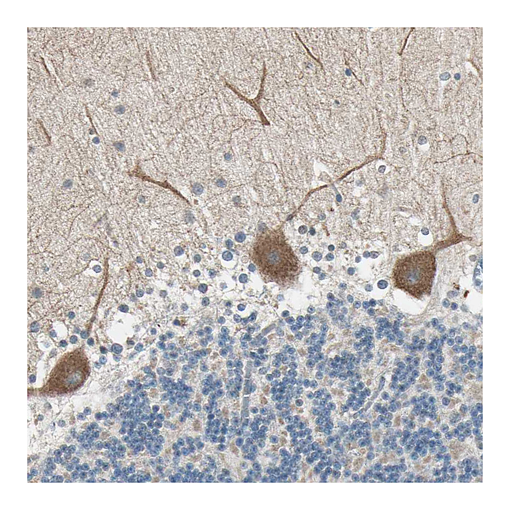 Atlas Antibodies Anti-MAP3K21 Antibody