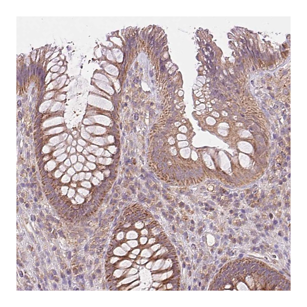 Atlas Antibodies Anti-MAP3K5 Antibody