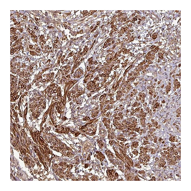 Atlas Antibodies Anti-MAP3K6 Antibody