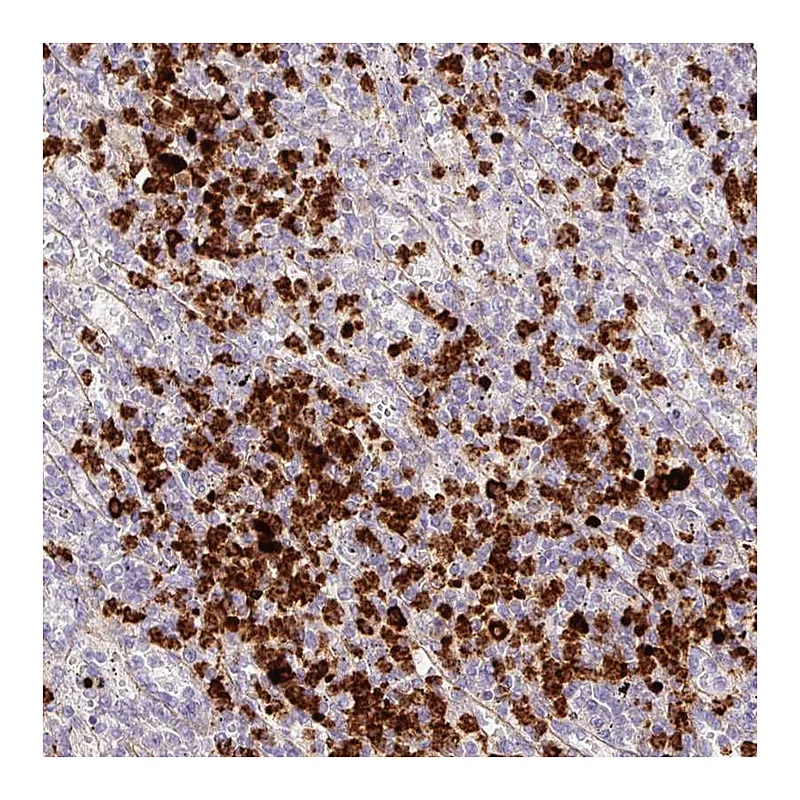 Atlas Antibodies Anti-MAP3K3 Antibody