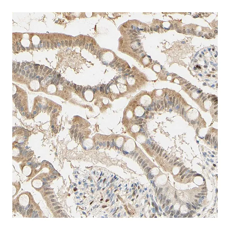 Atlas Antibodies Anti-MAP3K4 Antibody
