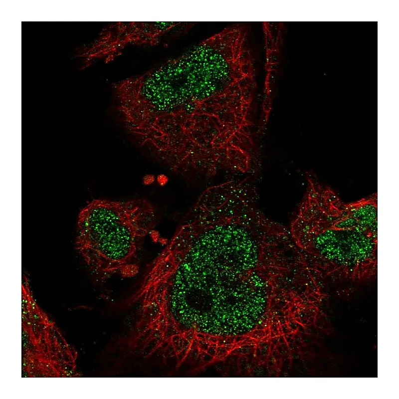 Atlas Antibodies Anti-MAP3K3 Antibody
