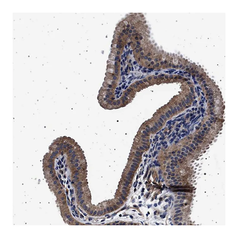 Atlas Antibodies Anti-MAP3K2 Antibody