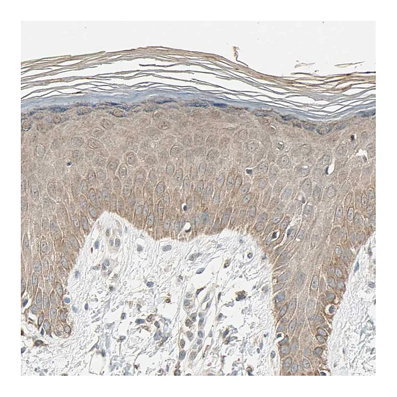 Atlas Antibodies Anti-MAP3K7 Antibody