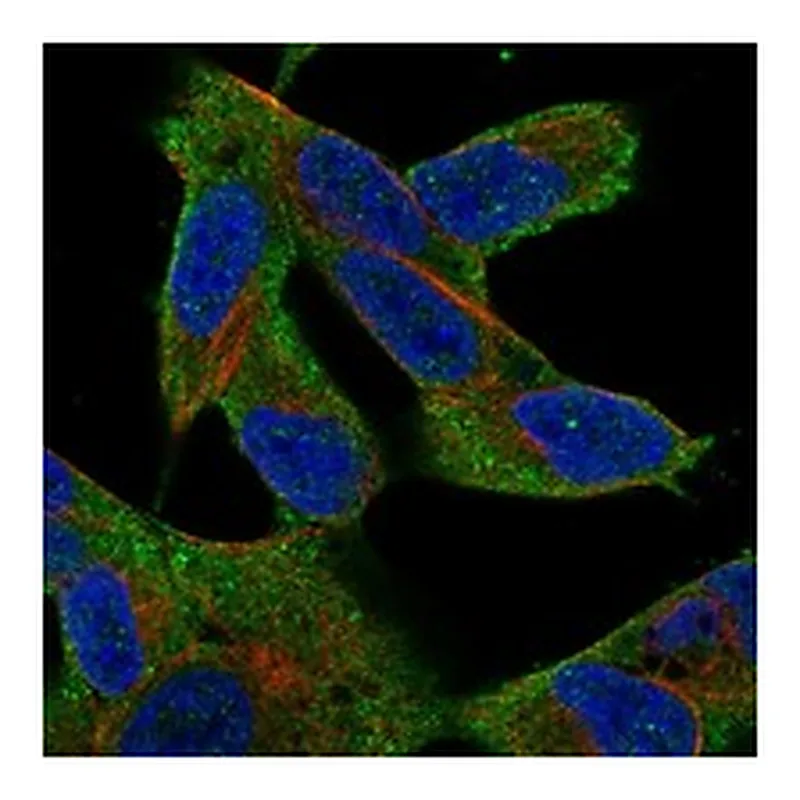 Atlas Antibodies Anti-MAP3K7 Antibody