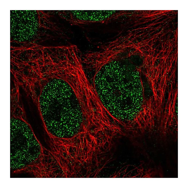 Atlas Antibodies Anti-MAP3K7CL Antibody