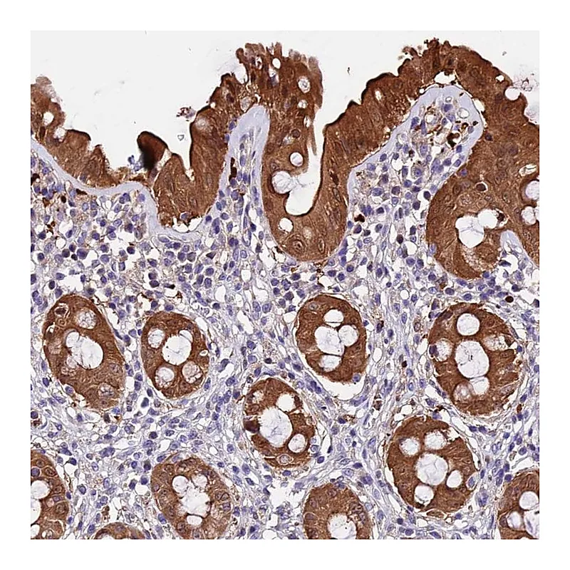 Atlas Antibodies Anti-MAP3K7CL Antibody