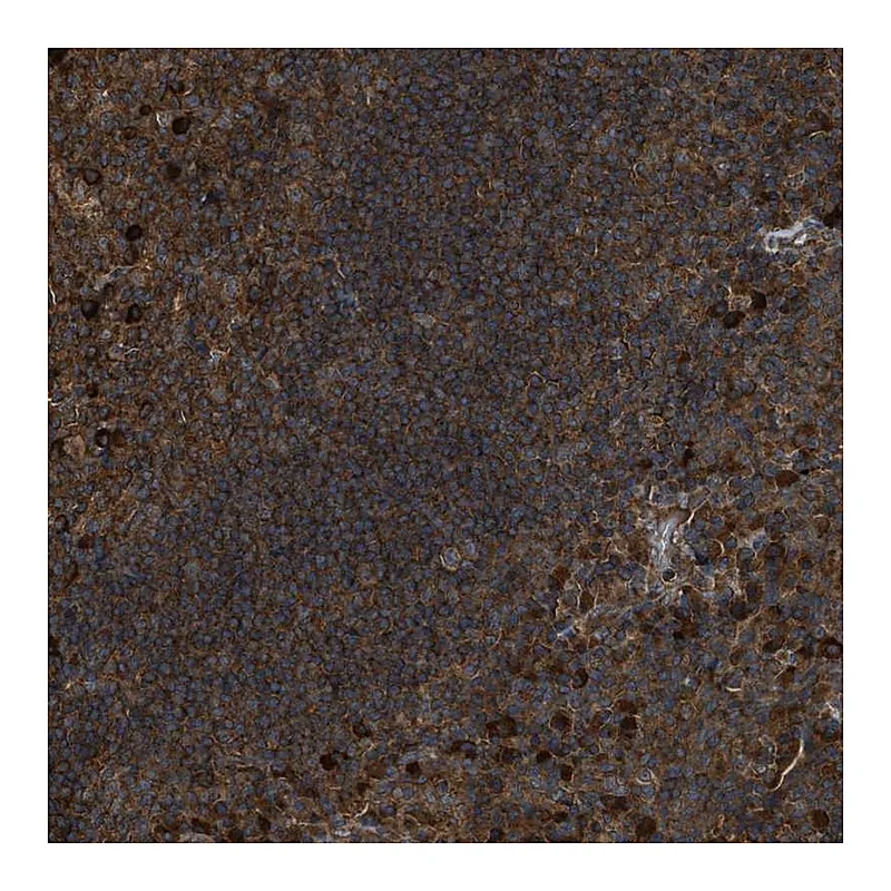 Atlas Antibodies Anti-MAP3K8 Antibody