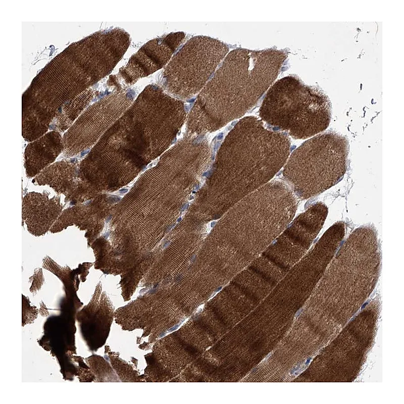 Atlas Antibodies Anti-MAP4K3 Antibody