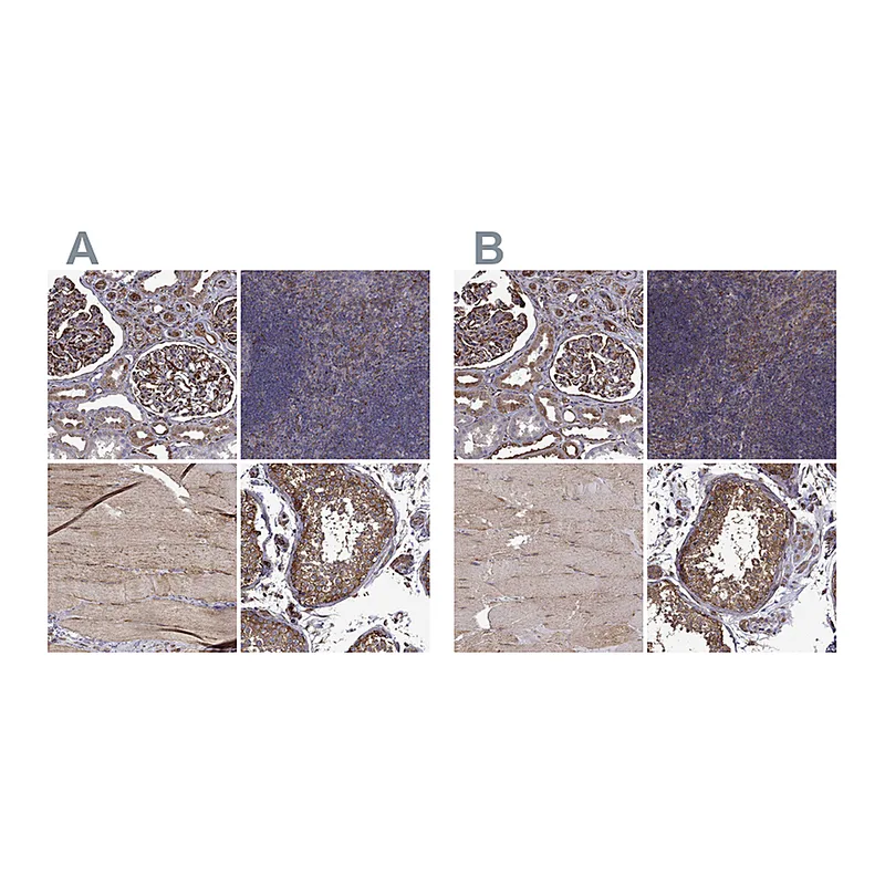 Atlas Antibodies Anti-MAP4 Antibody