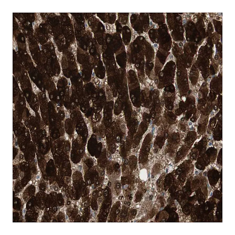 Atlas Antibodies Anti-MAP4K4 Antibody
