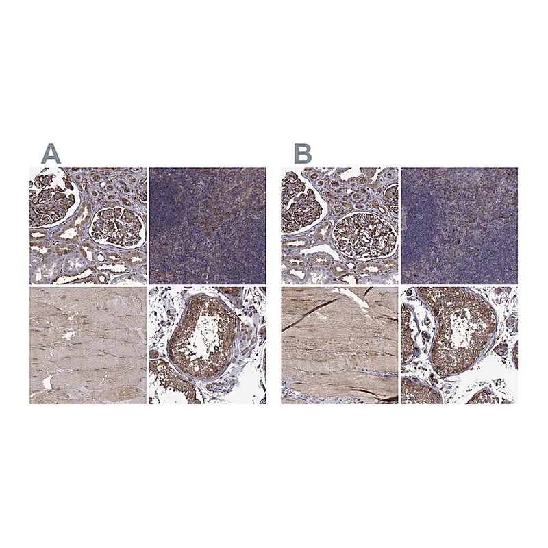 Atlas Antibodies Anti-MAP4 Antibody