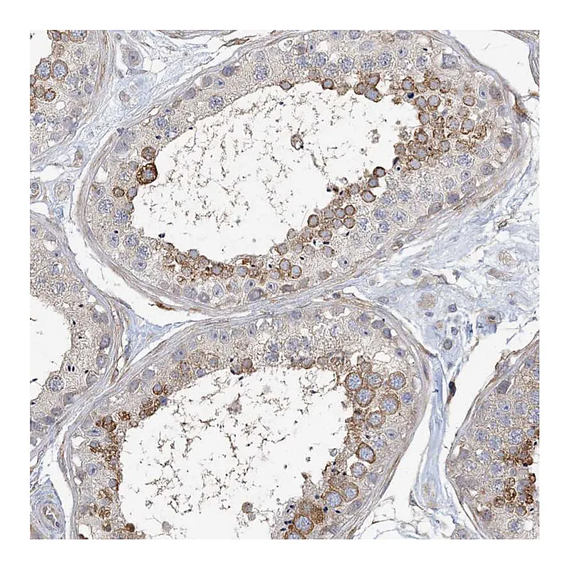 Atlas Antibodies Anti-MAP4K5 Antibody