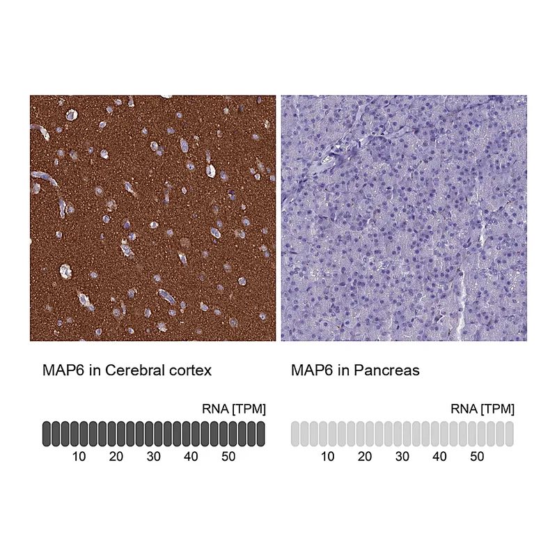 Atlas Antibodies Anti-MAP6 Antibody