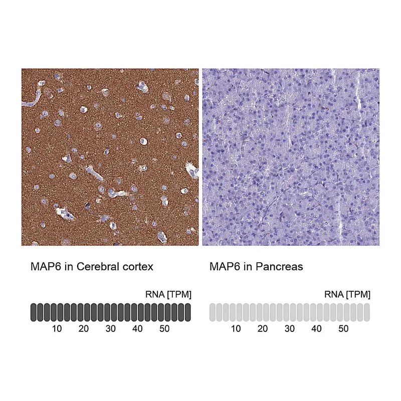 Atlas Antibodies Anti-MAP6 Antibody