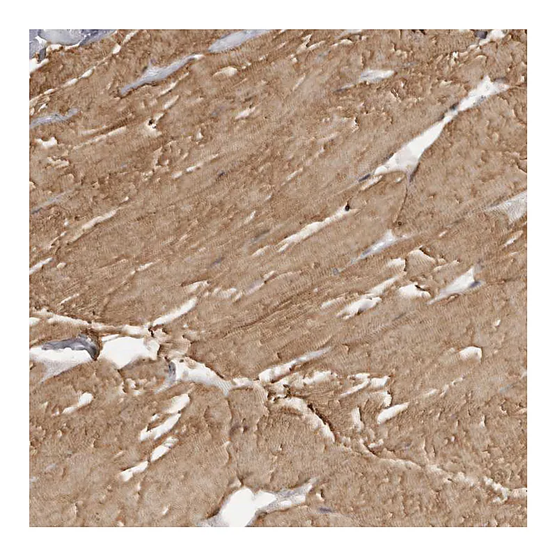 Atlas Antibodies Anti-MAP7D1 Antibody