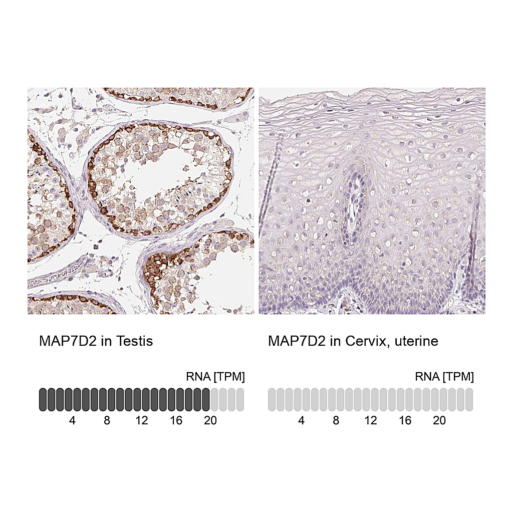 Atlas Antibodies Anti-MAP7D2 Antibody