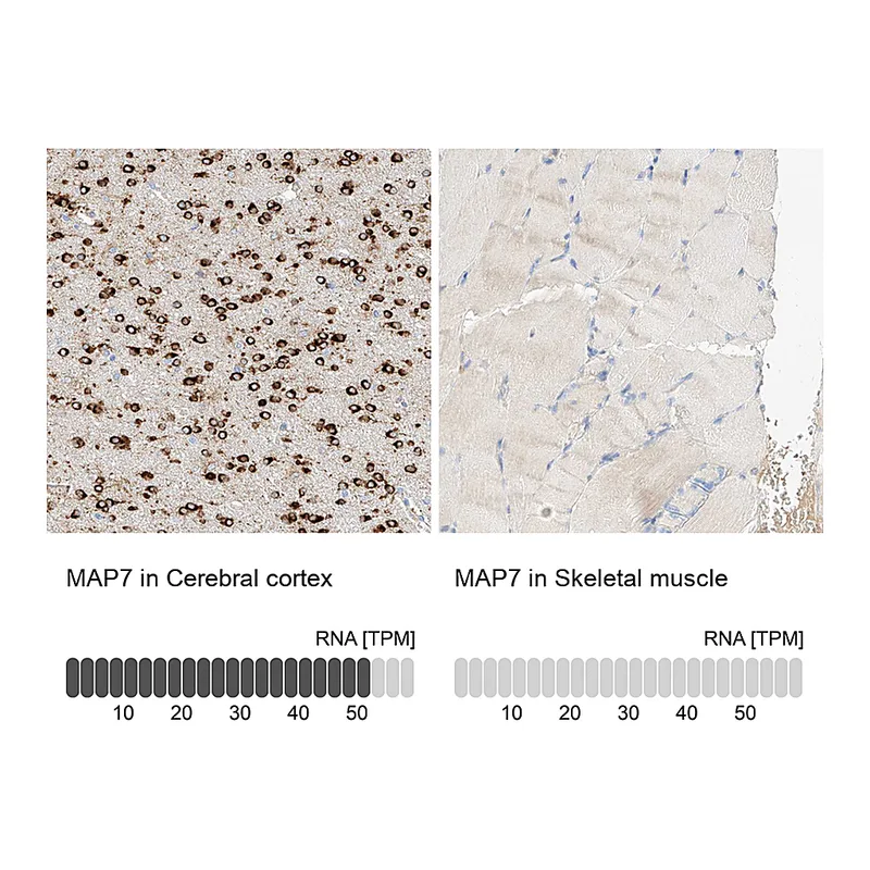 Atlas Antibodies Anti-MAP7 Antibody