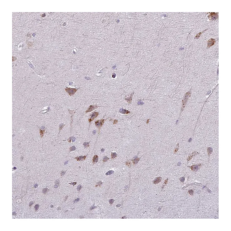 Atlas Antibodies Anti-MAP7D2 Antibody