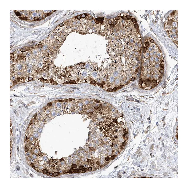 Atlas Antibodies Anti-MAP7D3 Antibody