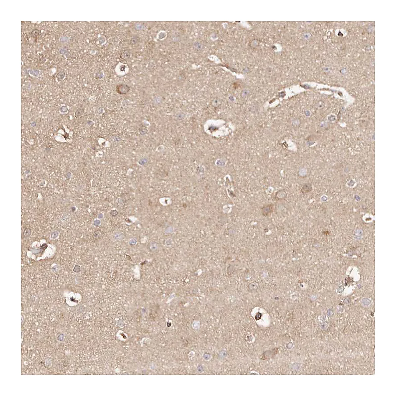Atlas Antibodies Anti-MAPK1 Antibody