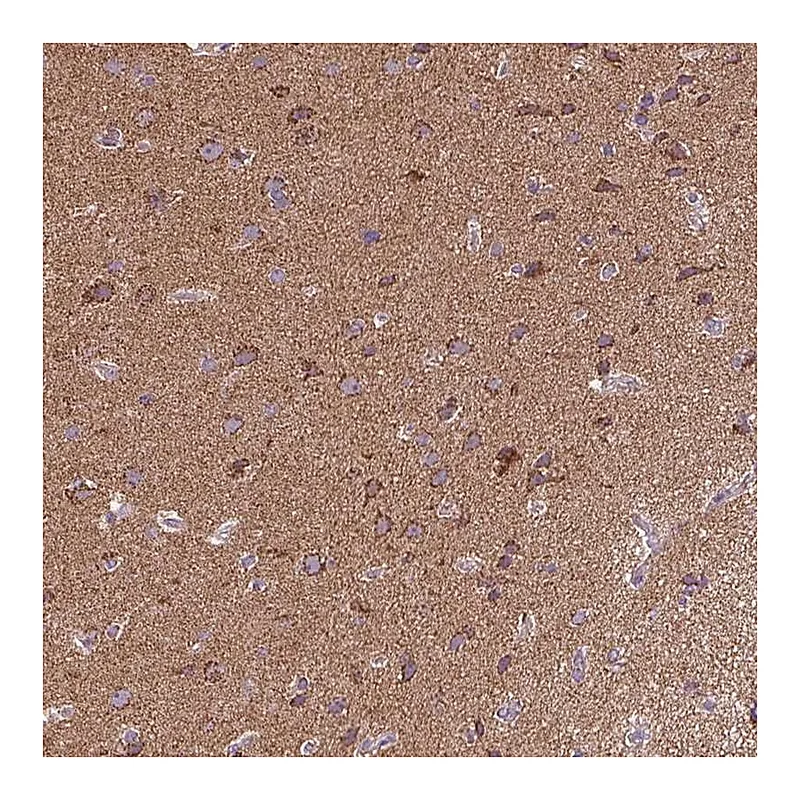 Atlas Antibodies Anti-MAPK11 Antibody