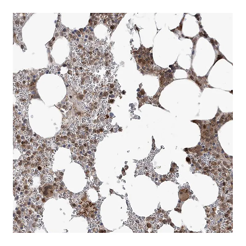 Atlas Antibodies Anti-MAPK1IP1L Antibody