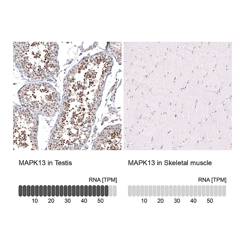 Atlas Antibodies Anti-MAPK13 Antibody