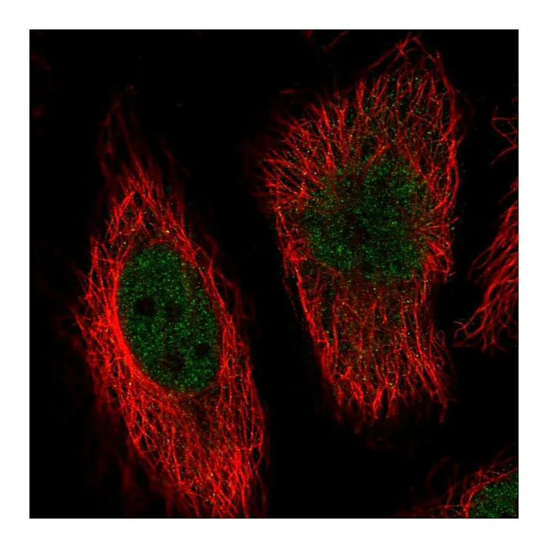 Atlas Antibodies Anti-MAPK7 Antibody