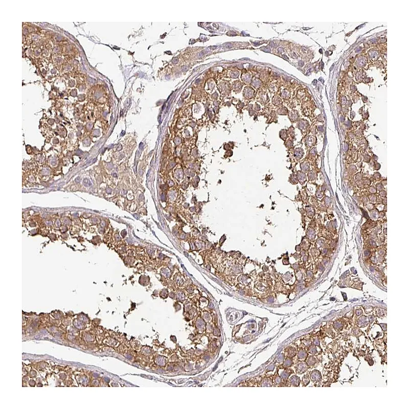 Atlas Antibodies Anti-MAPK8IP3 Antibody