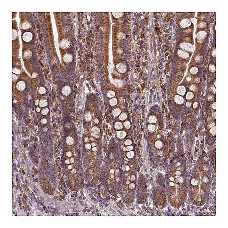 Atlas Antibodies Anti-MAPK8IP3 Antibody