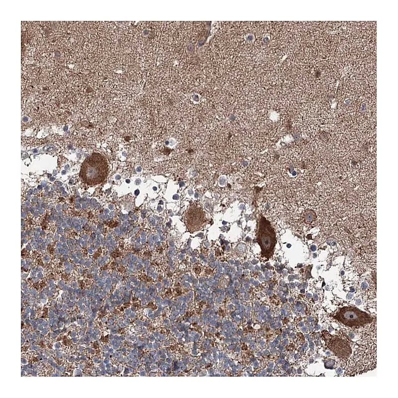 Atlas Antibodies Anti-MAPK8IP2 Antibody
