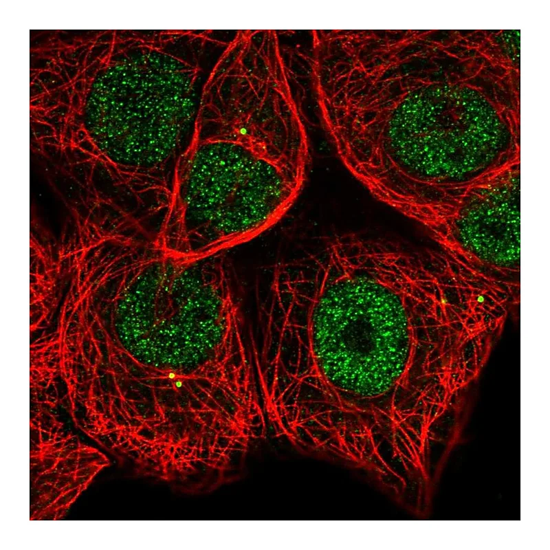 Atlas Antibodies Anti-MAPKAPK2 Antibody