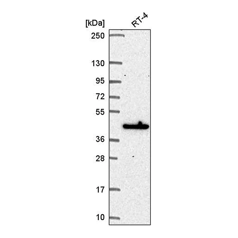 Atlas Antibodies Anti-MAPKAPK3 Antibody