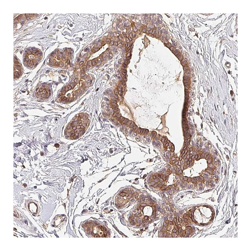 Atlas Antibodies Anti-MAPKAPK2 Antibody