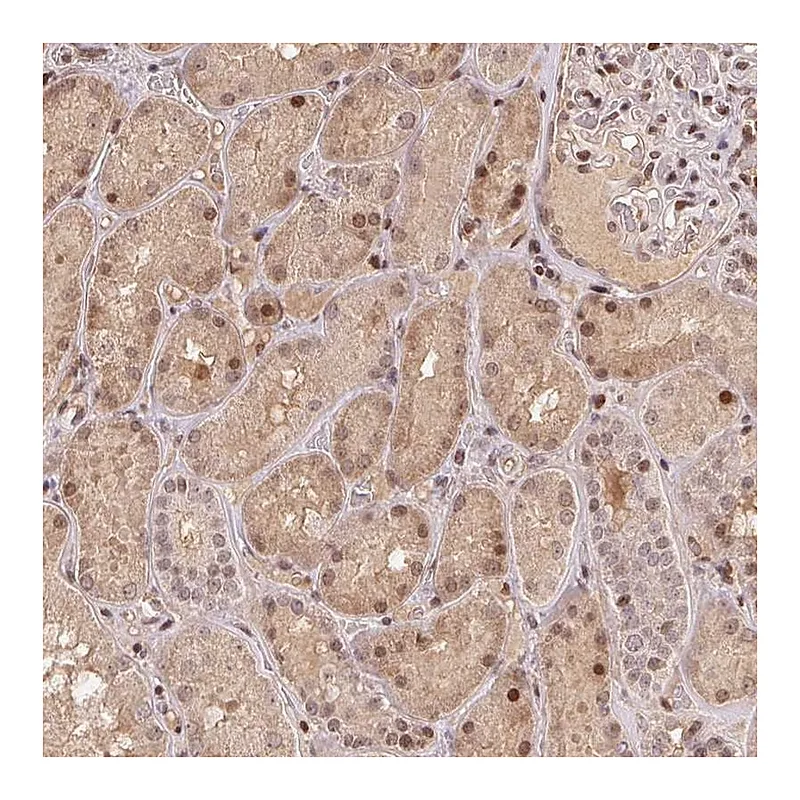 Atlas Antibodies Anti-MAPKAPK2 Antibody