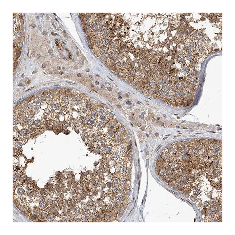 Atlas Antibodies Anti-MAPKBP1 Antibody