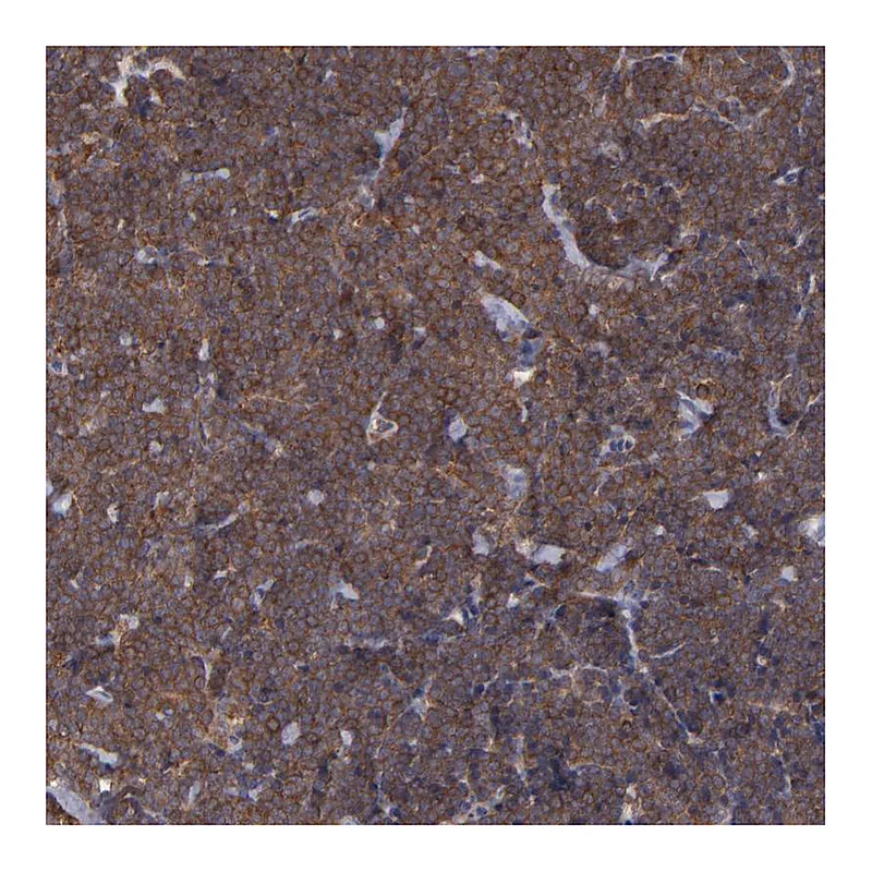 Atlas Antibodies Anti-MAPRE1 Antibody