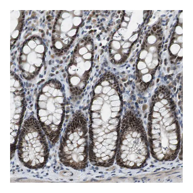 Atlas Antibodies Anti-MAPKAPK5 Antibody