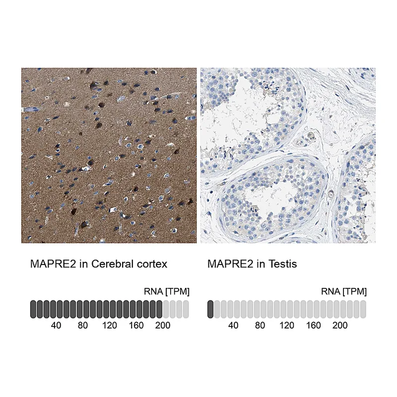 Atlas Antibodies Anti-MAPRE2 Antibody