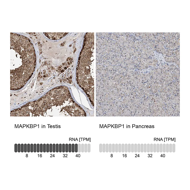 Atlas Antibodies Anti-MAPKBP1 Antibody